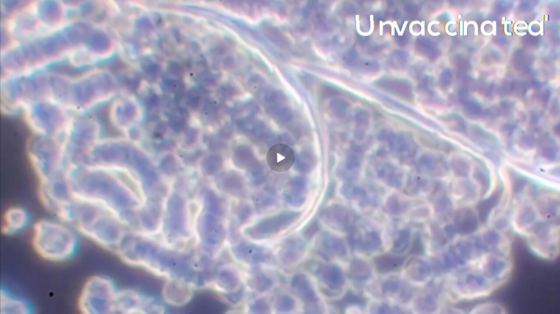 Nano lipid particles in unvaccinated blood