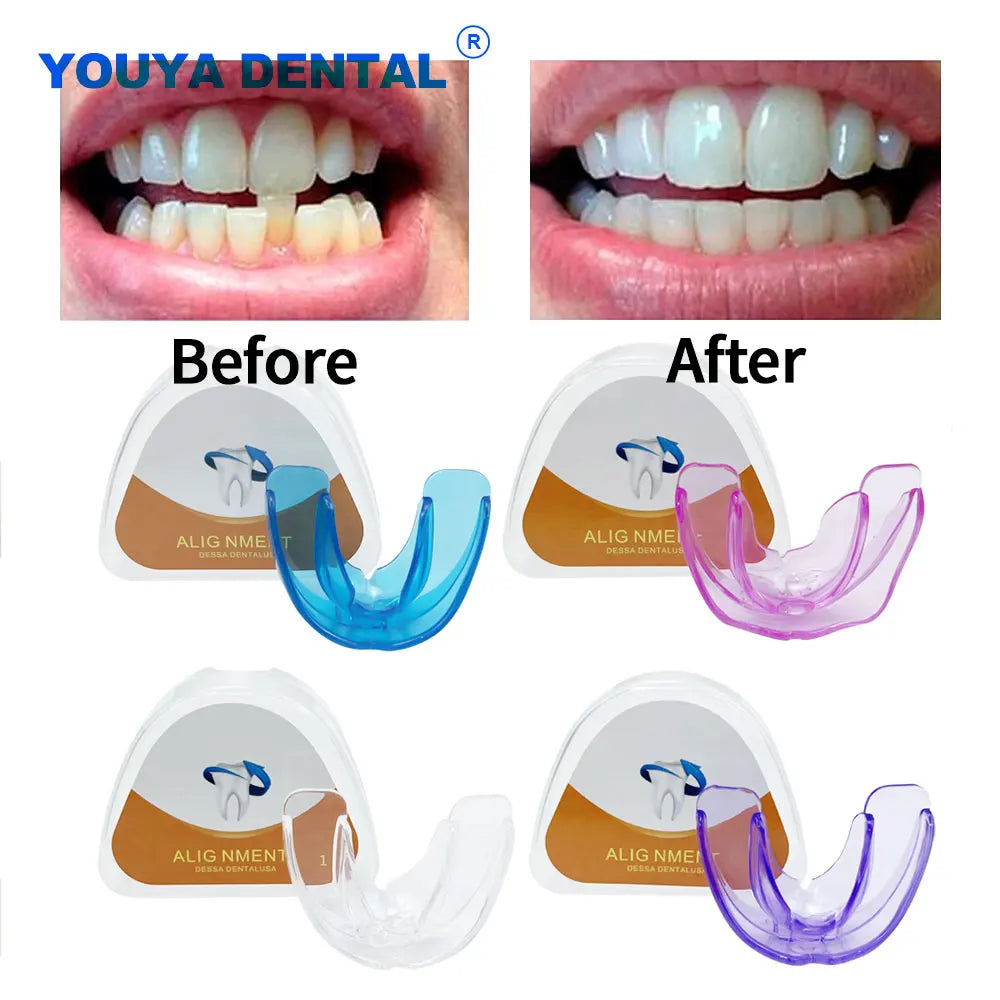 Silicone Teeth Braces Teeth Alignment Mouth Guard Braces 3 Phases