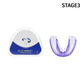 Silicone Teeth Braces Teeth Alignment Mouth Guard Braces 3 Phases